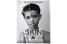 「Black Lives Matter」の高まり受け『SKIN』短編緊急配信 画像