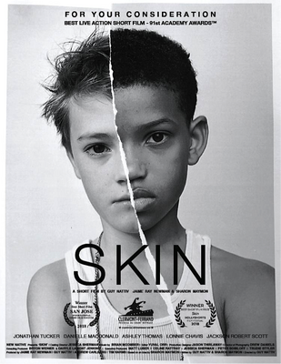『SKIN 短編』（C）NEW NATIVE PICTURES