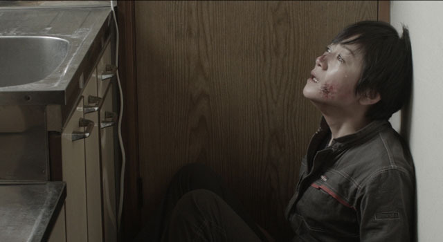 アルビノ 6枚目の写真・画像