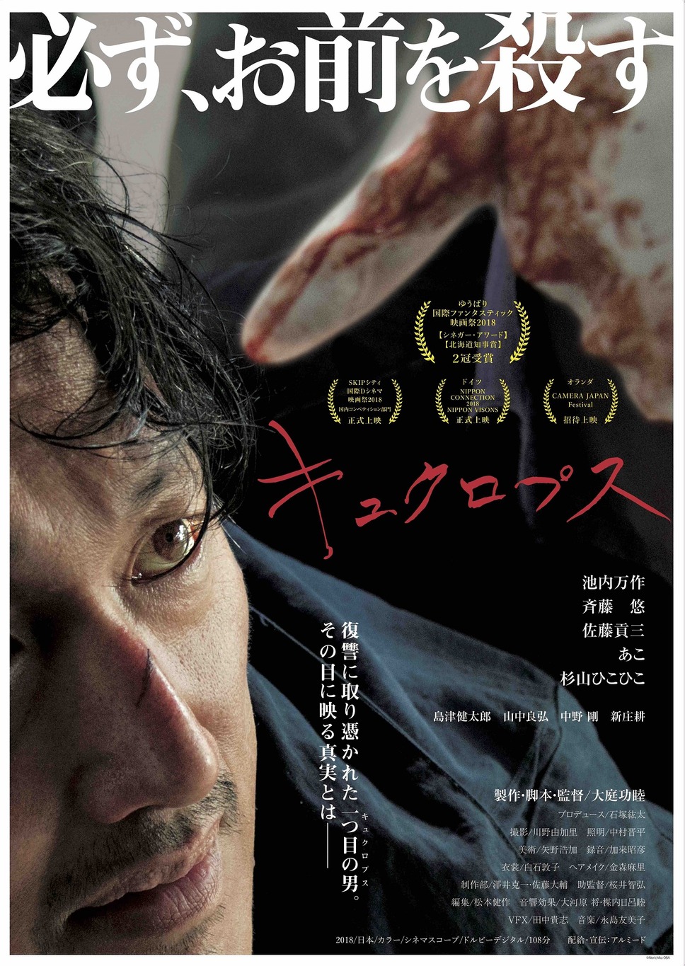 キュクロプス 1枚目の写真・画像