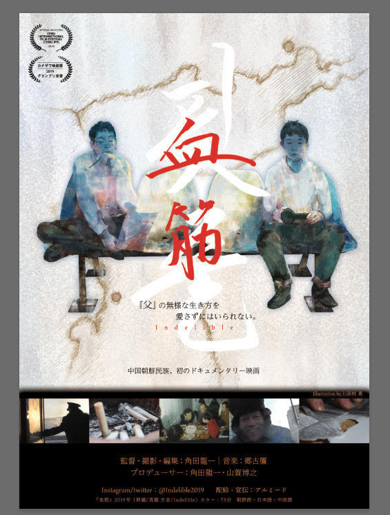 血筋 1枚目の写真・画像