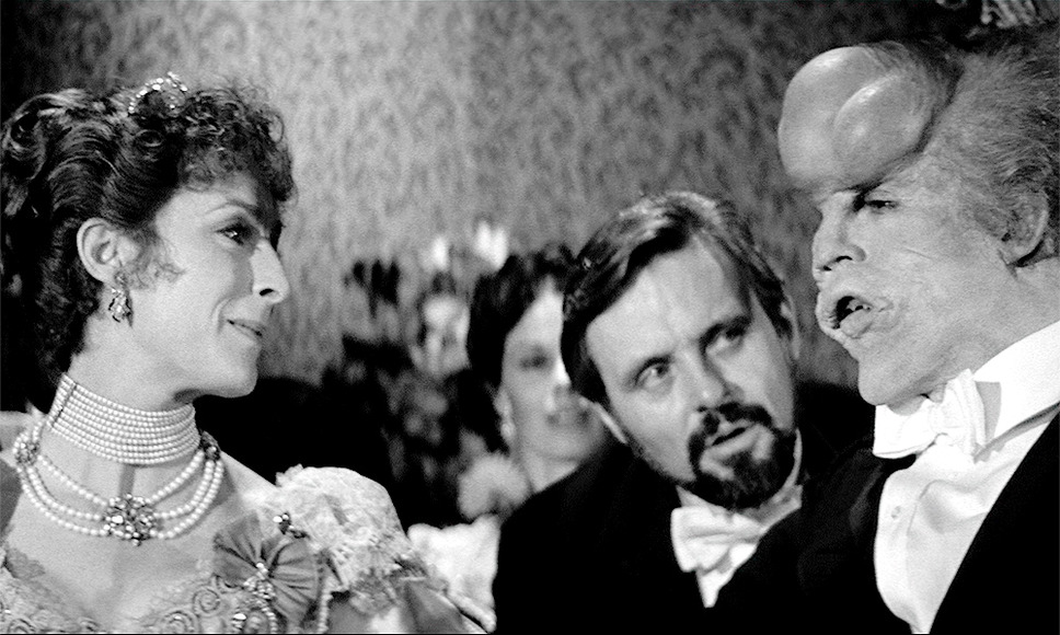 エレファント・マン　4K修復版 10枚目の写真・画像