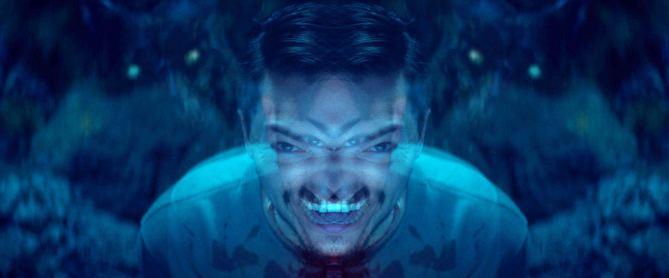 ハイポ 2枚目の写真・画像