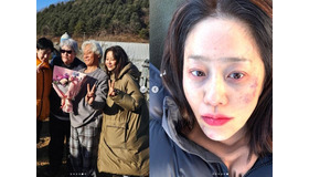 美人女優コ・ヒョンジョンがあざだらけの顔に(涙) 何があった?　実は……