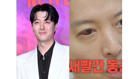 バツイチの『七日の王妃』俳優イ・ドンゴン、“人口1％の希少疾患”診断に衝撃。ファンから心配の声続々