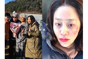 美人女優コ・ヒョンジョンがあざだらけの顔に(涙) 何があった?　実は…… 画像