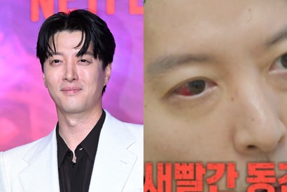 バツイチの『七日の王妃』俳優イ・ドンゴン、“人口1％の希少疾患”診断に衝撃。ファンから心配の声続々 画像