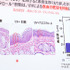 「アロエに含まれる新成分の美肌効果に関する研究結果発表」会見