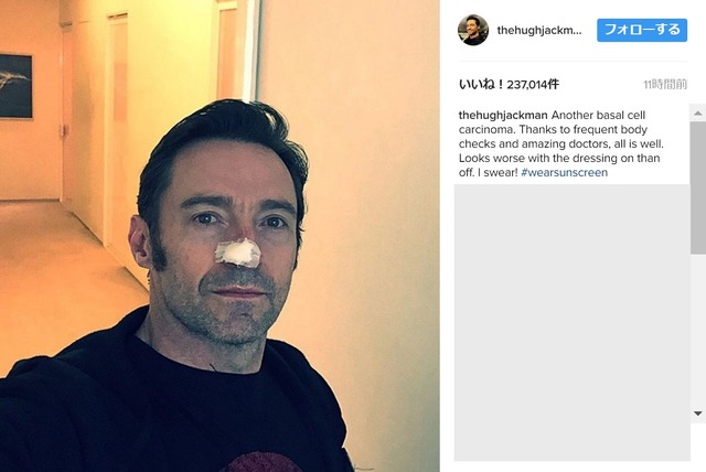 ヒュー・ジャックマン-(C)Instagram