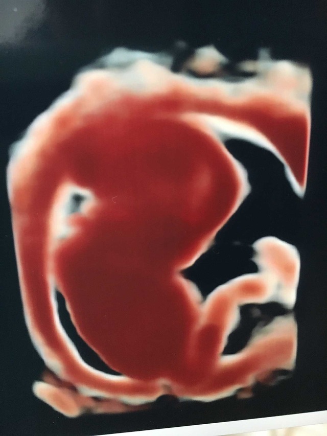 Cinemage: ハロー、ワールド（後）